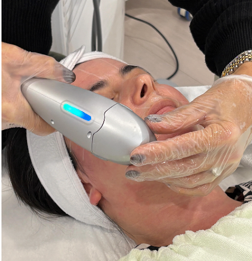 UltraFormer III for Skin Tightening: Non Surgical Facelift Gordon NSW