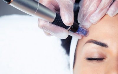 What is mesotherapy and how it can improve your skin?￼